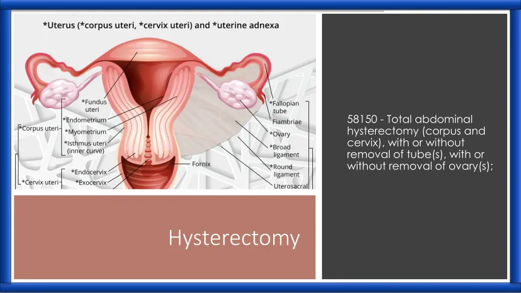 58150 total abdominal hysterectomy corpus