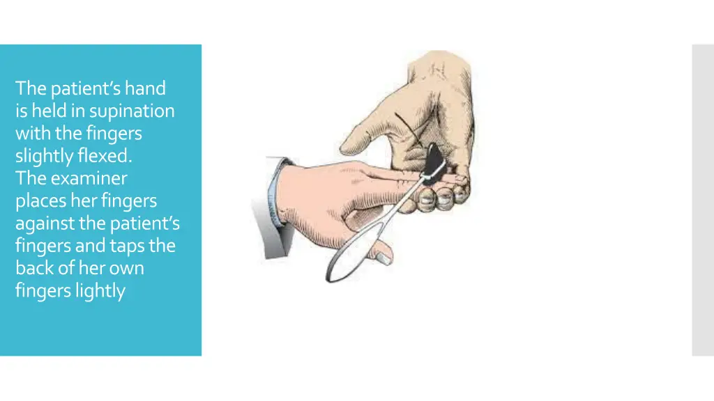 the patient s hand is held in supination with