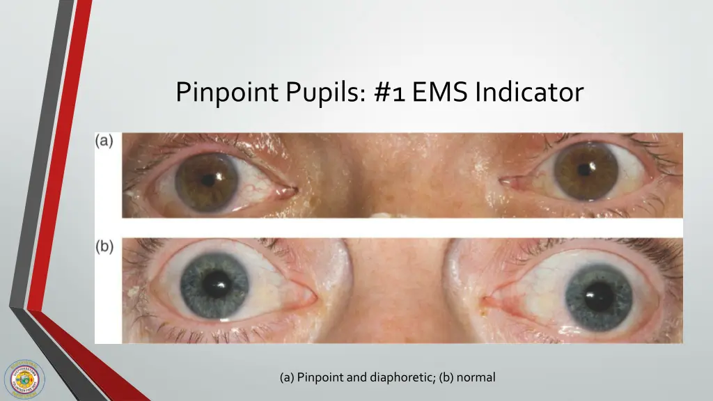 pinpoint pupils 1 ems indicator