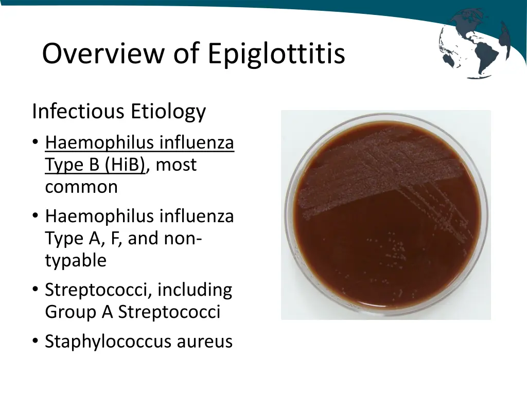 overview of epiglottitis