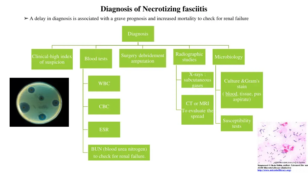 diagnosis of necrotizing fasciitis