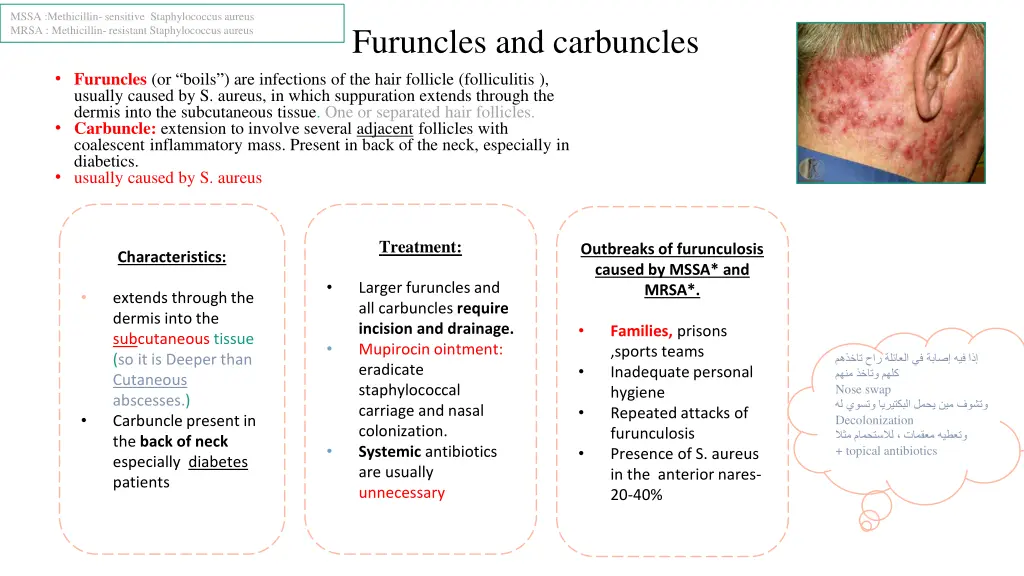 mssa methicillin sensitive staphylococcus aureus