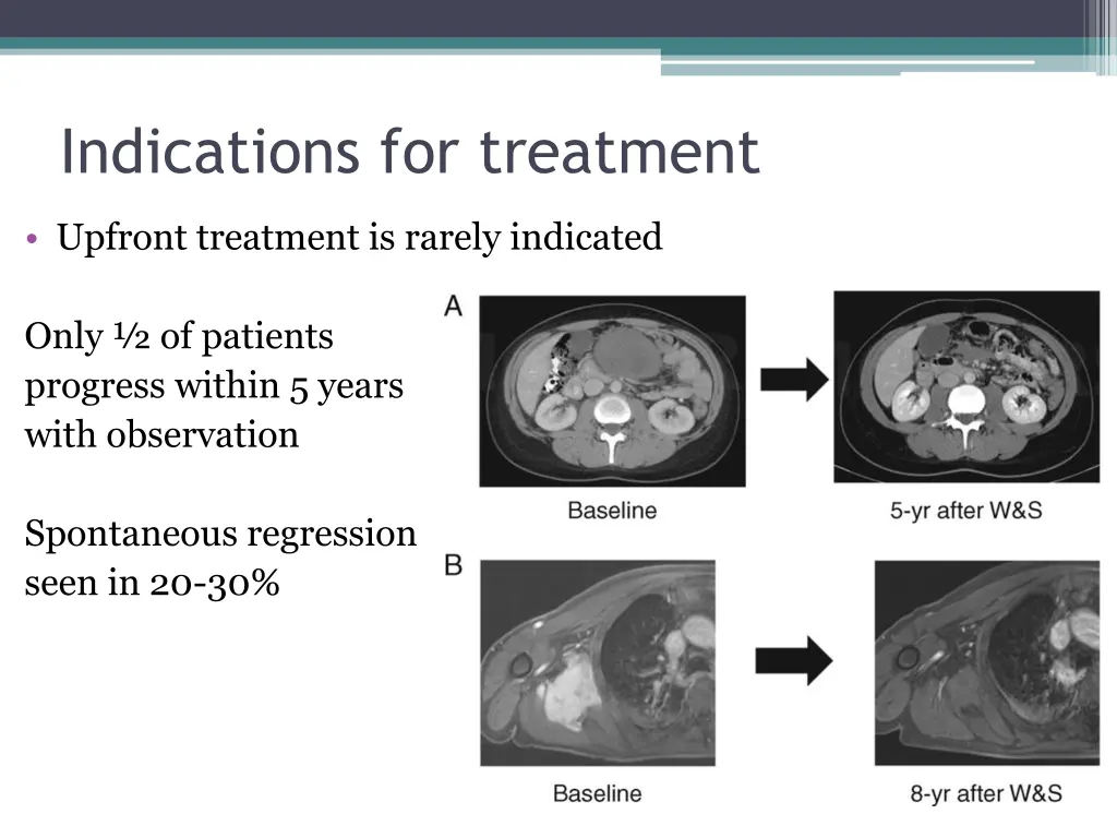 indications for treatment