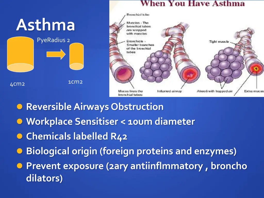 asthma pyeradius 2