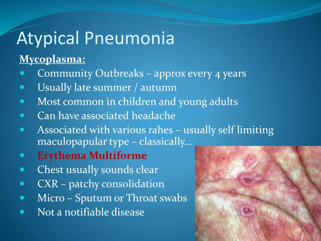 atypical pneumonia