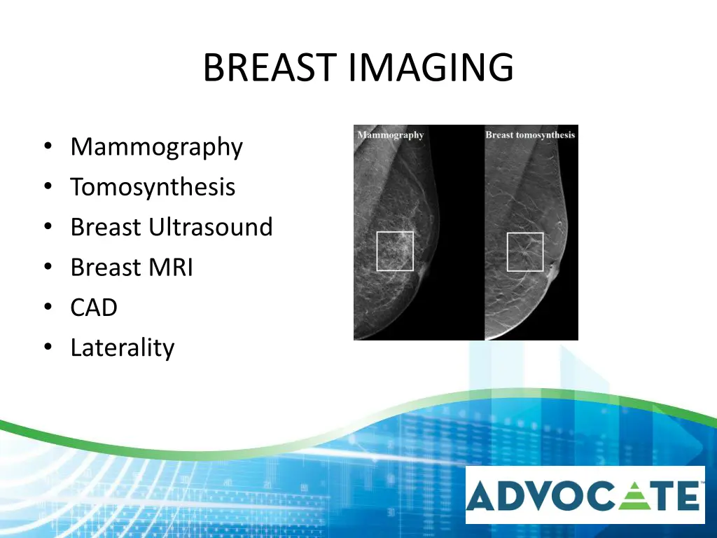 breast imaging