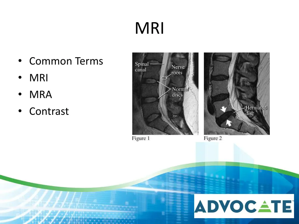 slide13