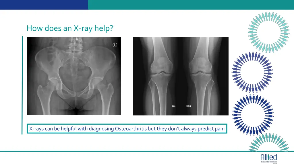 how does an x ray help