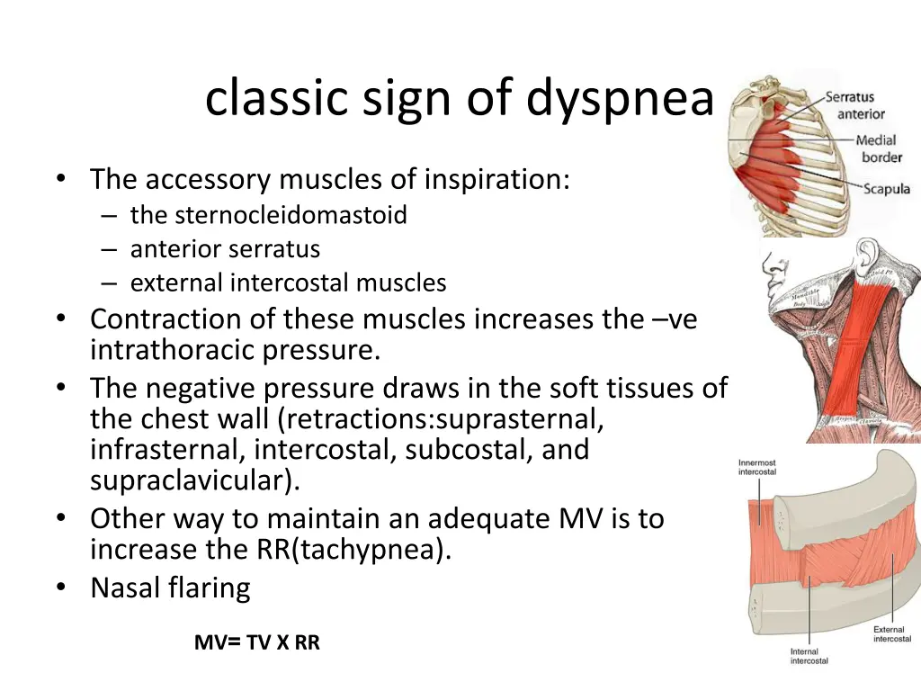 classic sign of dyspnea