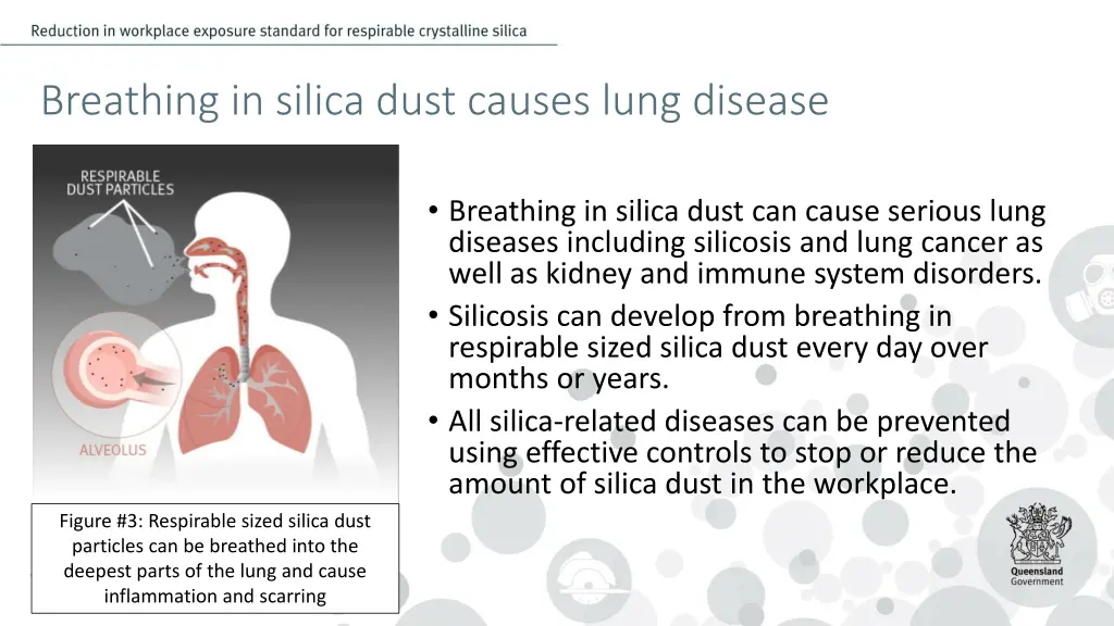 breathing in silica dust causes lung disease