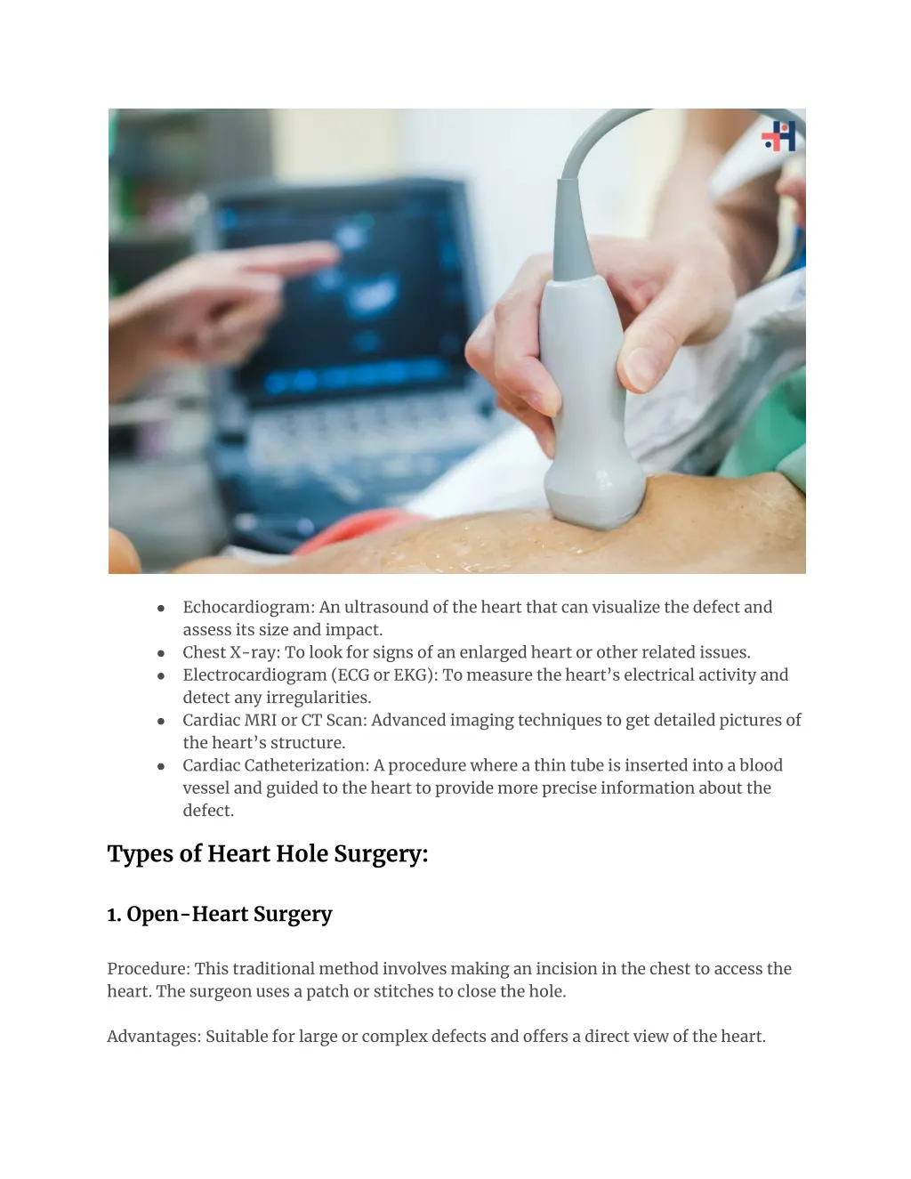 echocardiogram an ultrasound of the heart that