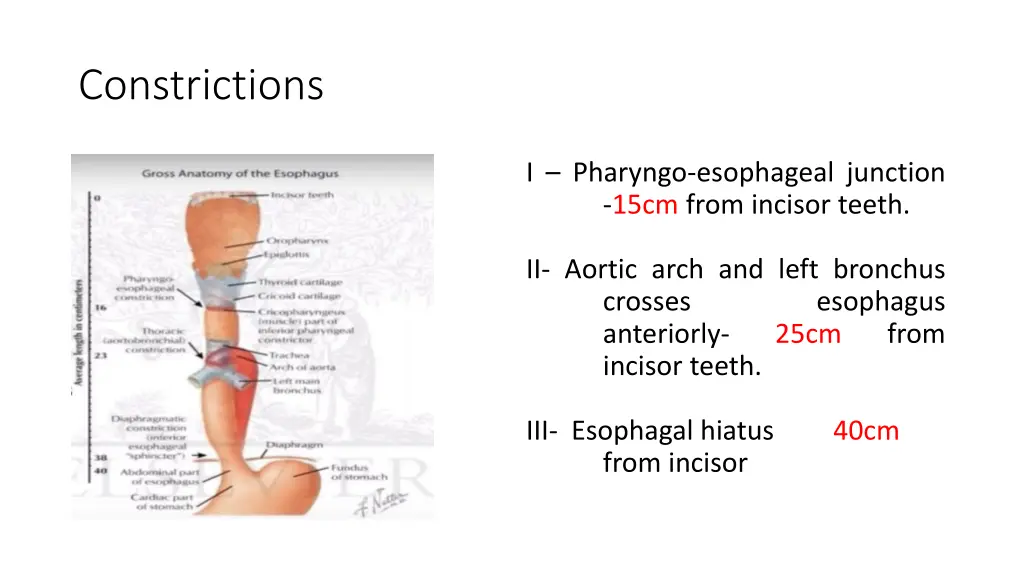 constrictions