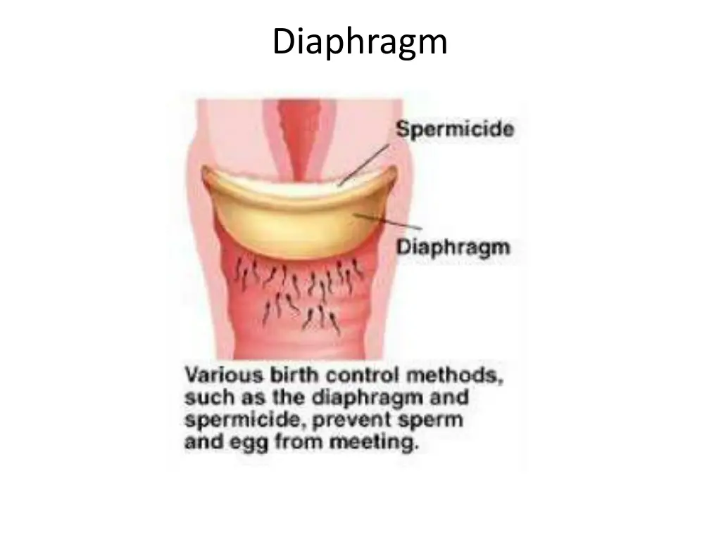 diaphragm