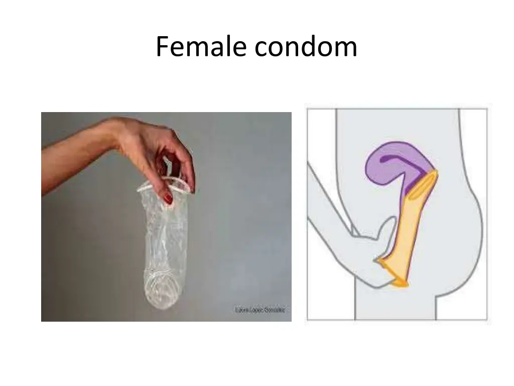 female condom