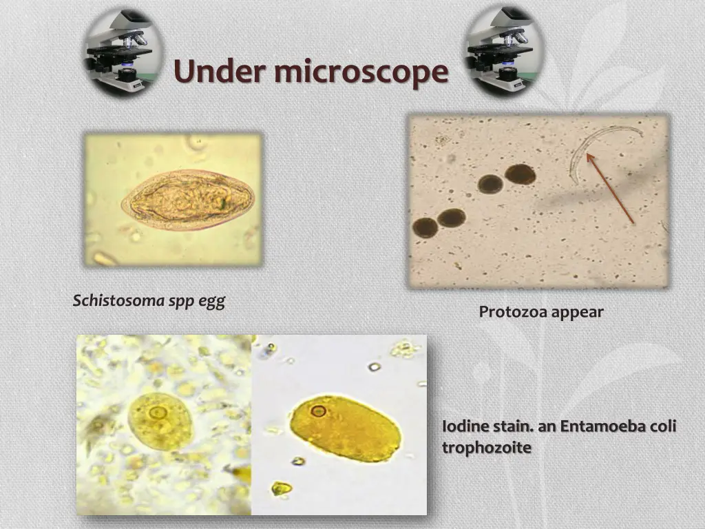 under microscope