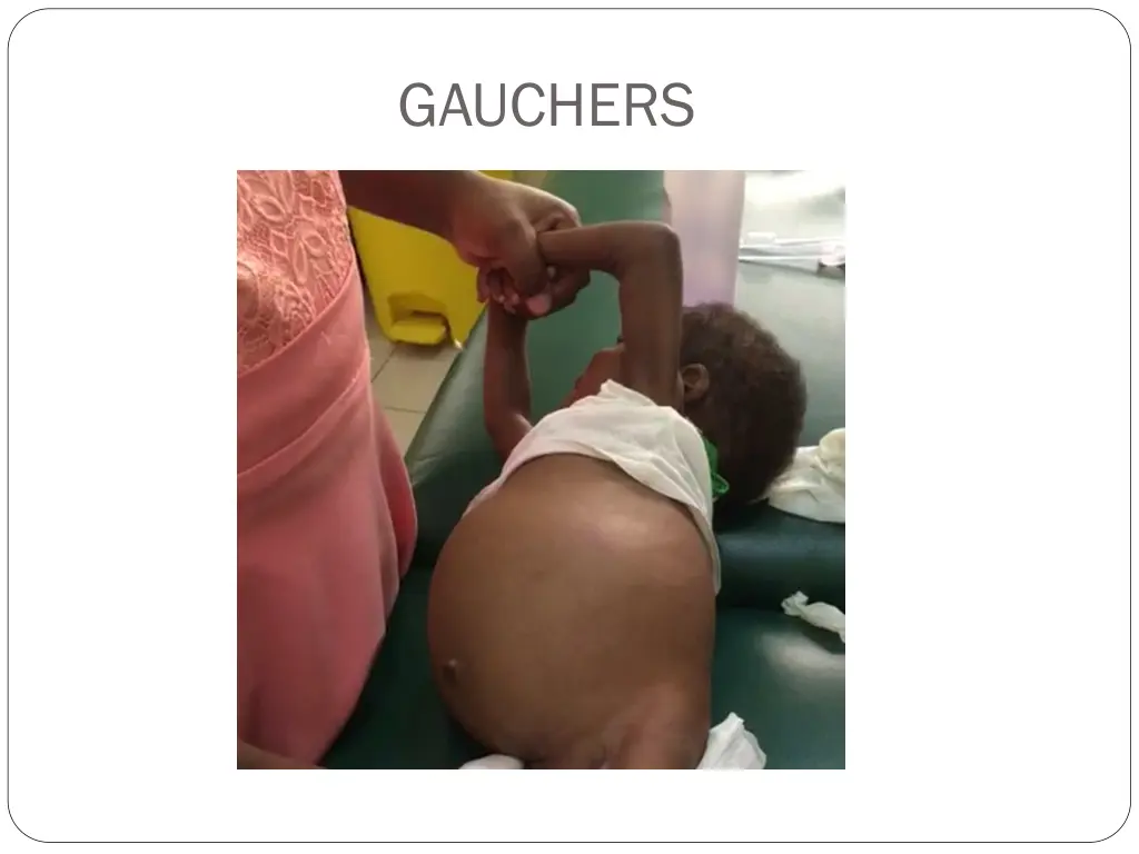 gauchers