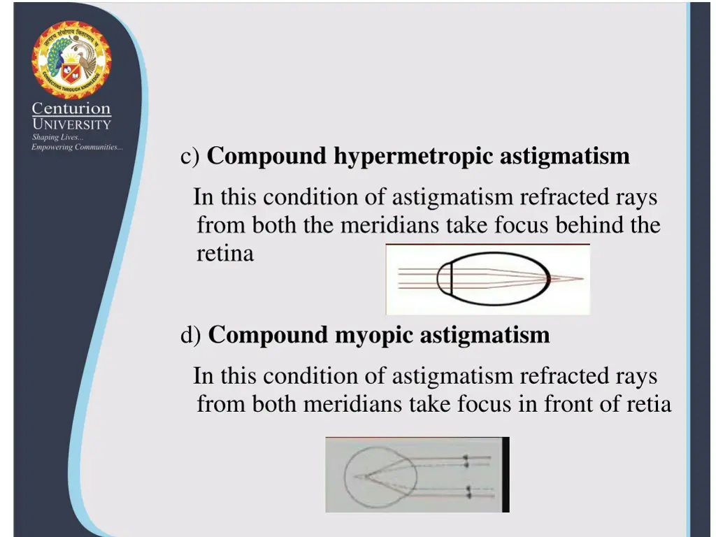 c compound hypermetropic astigmatism in this