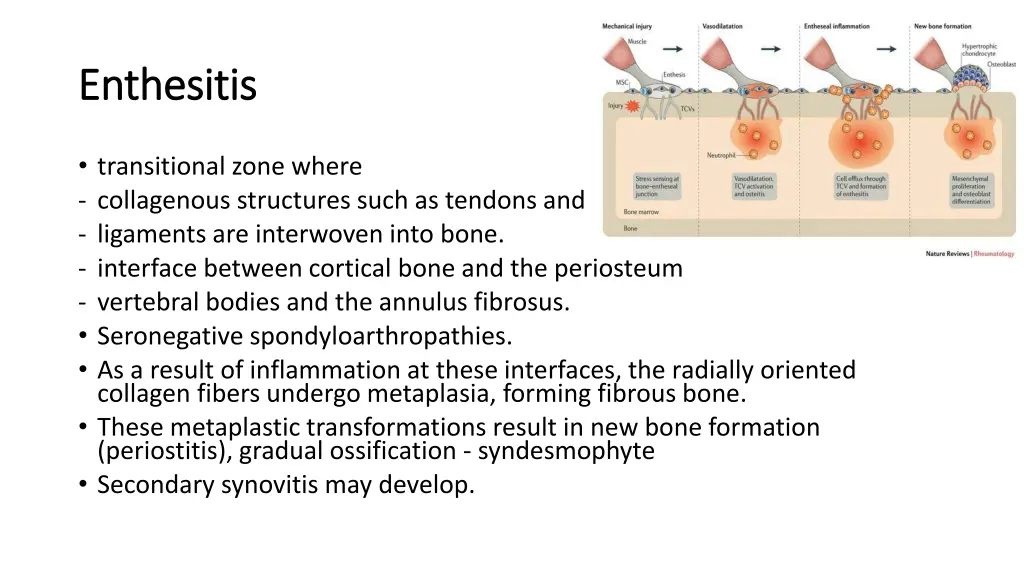 enthesitis enthesitis