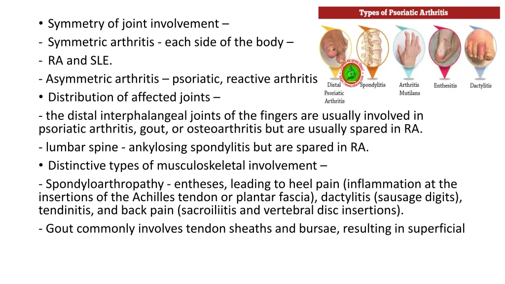 symmetry of joint involvement symmetric arthritis