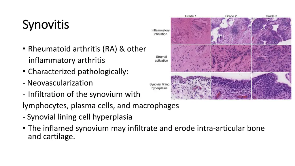 synovitis synovitis