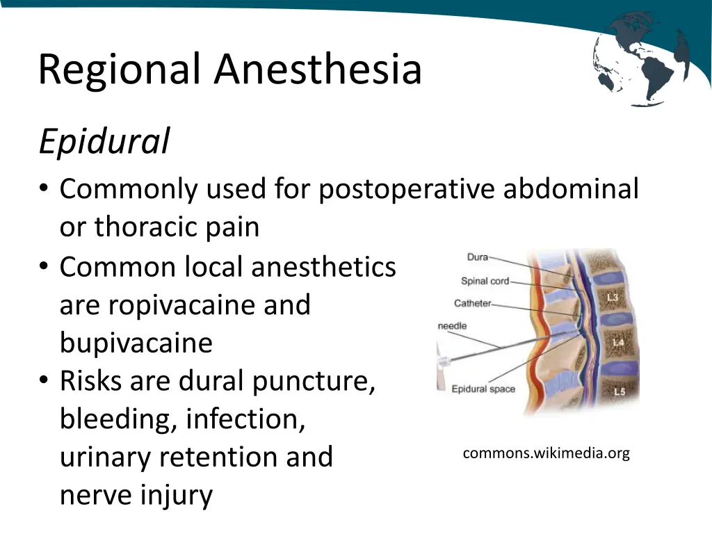 regional anesthesia