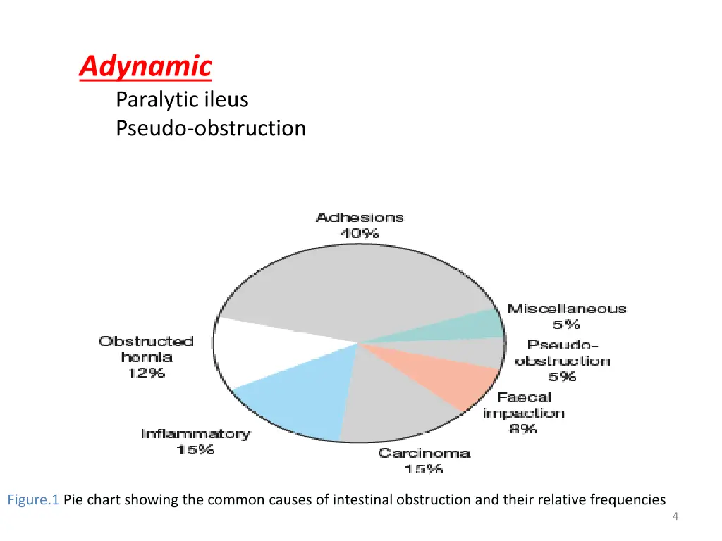 adynamic paralytic ileus pseudo obstruction