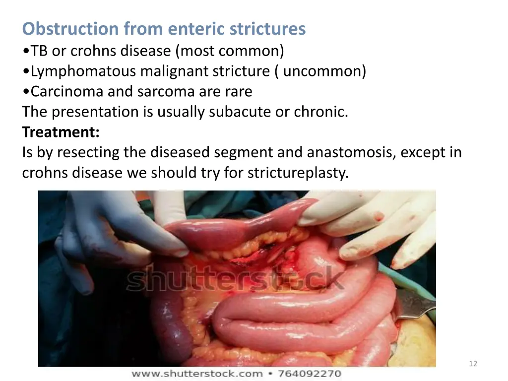 obstruction from enteric strictures tb or crohns