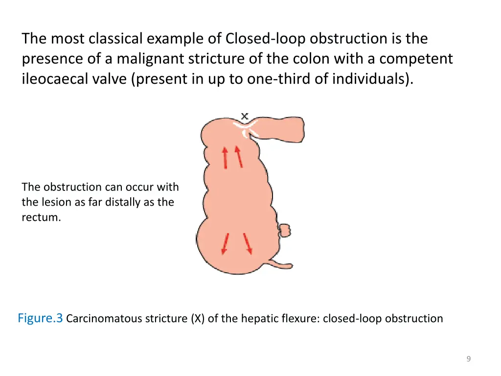 the most classical example of closed loop