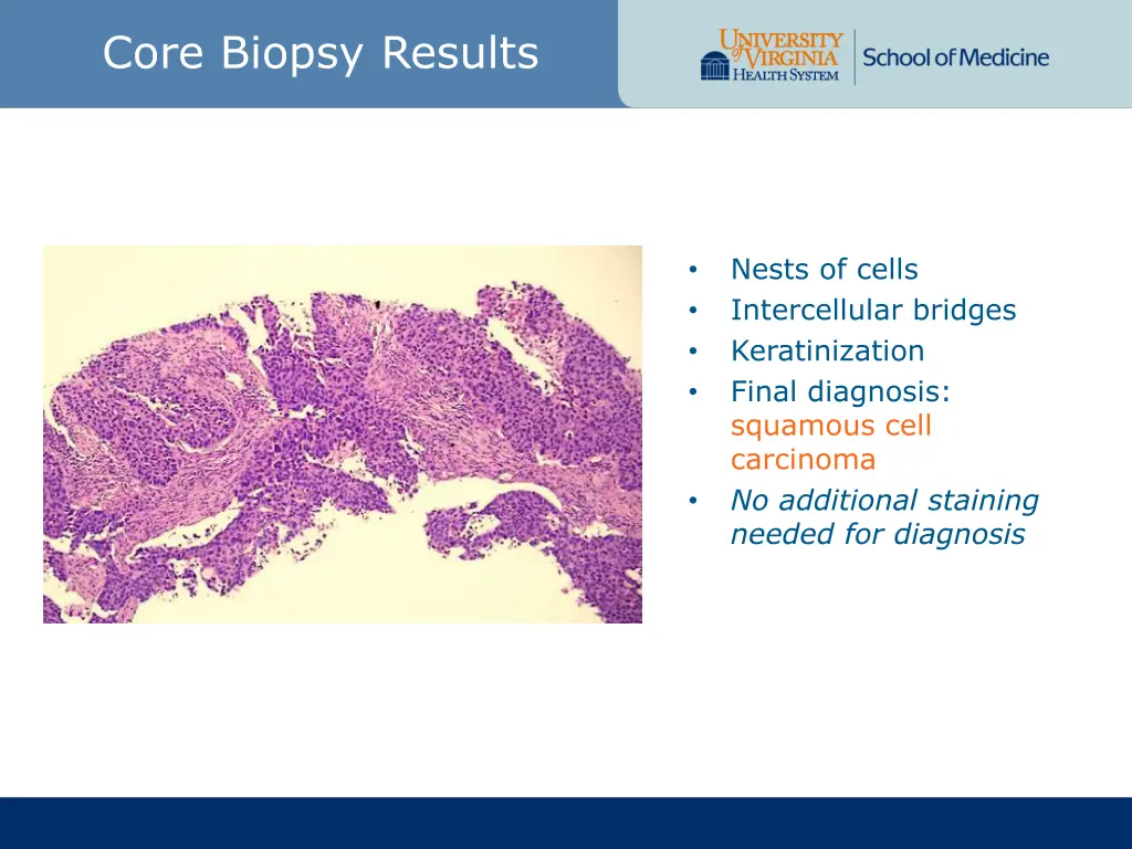 core biopsy results