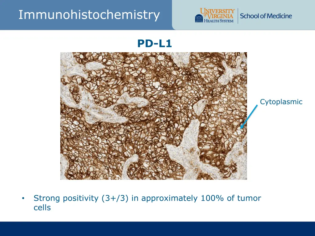 immunohistochemistry