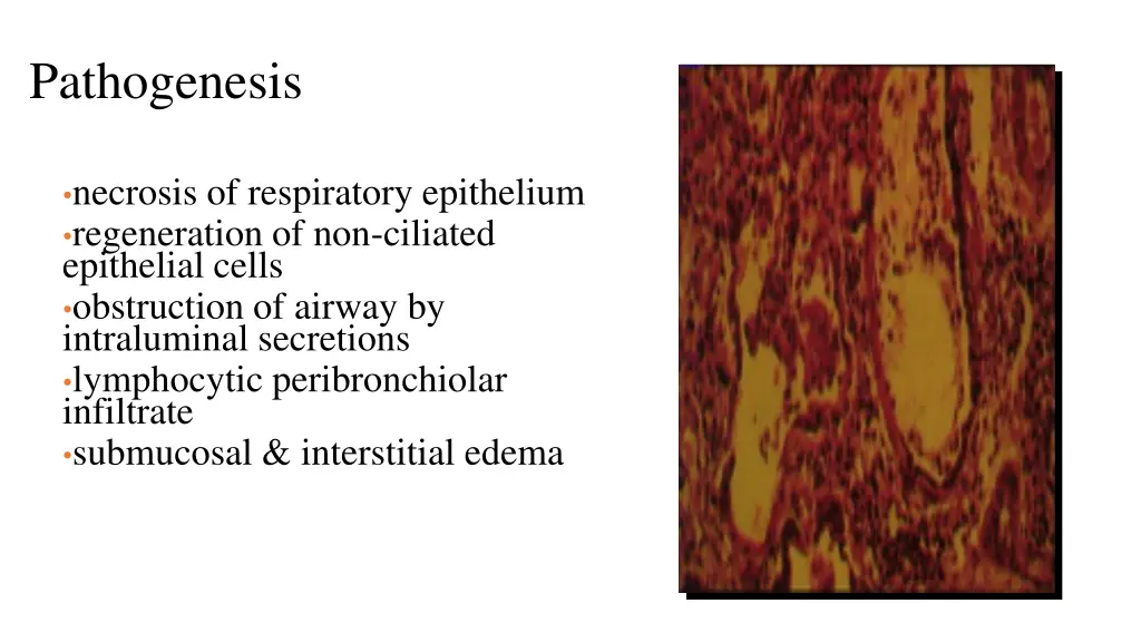 pathogenesis