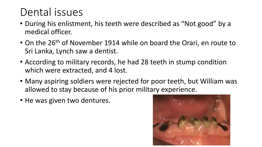 dental issues during his enlistment his teeth