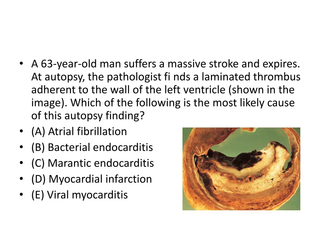 a 63 year old man suffers a massive stroke