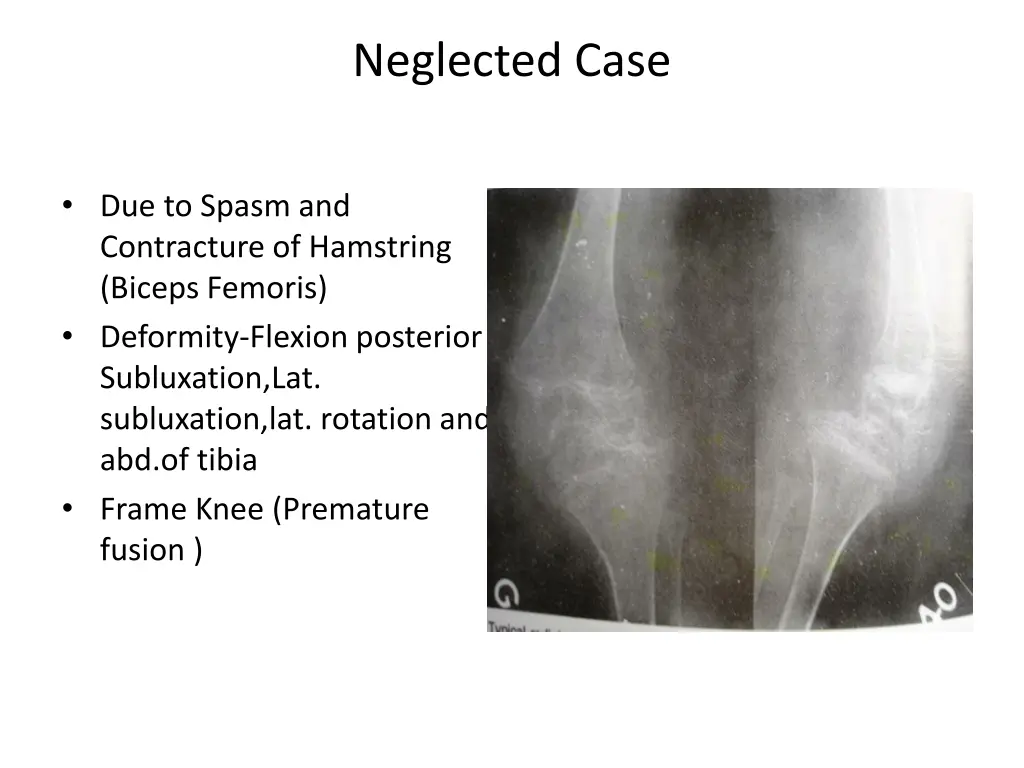 neglected case