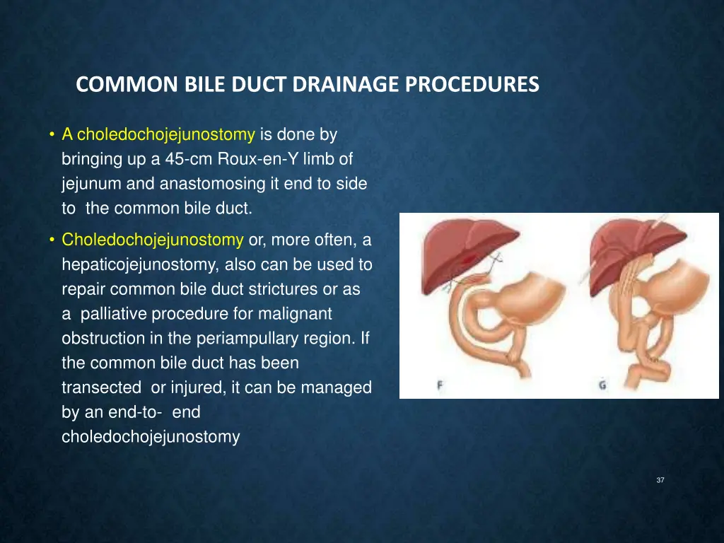 common bile duct drainage procedures 1