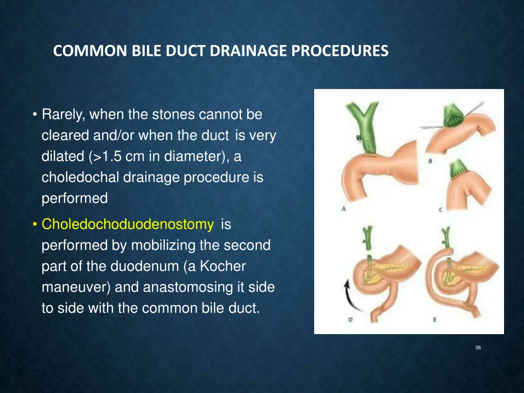 common bile duct drainage procedures