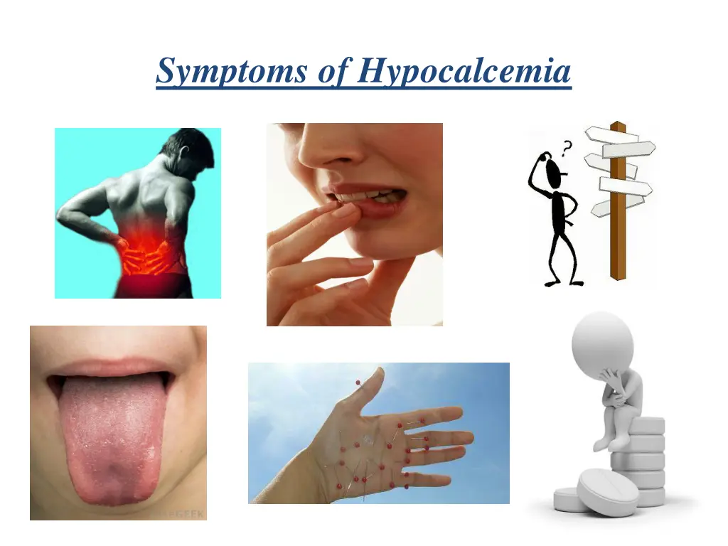 symptoms of hypocalcemia