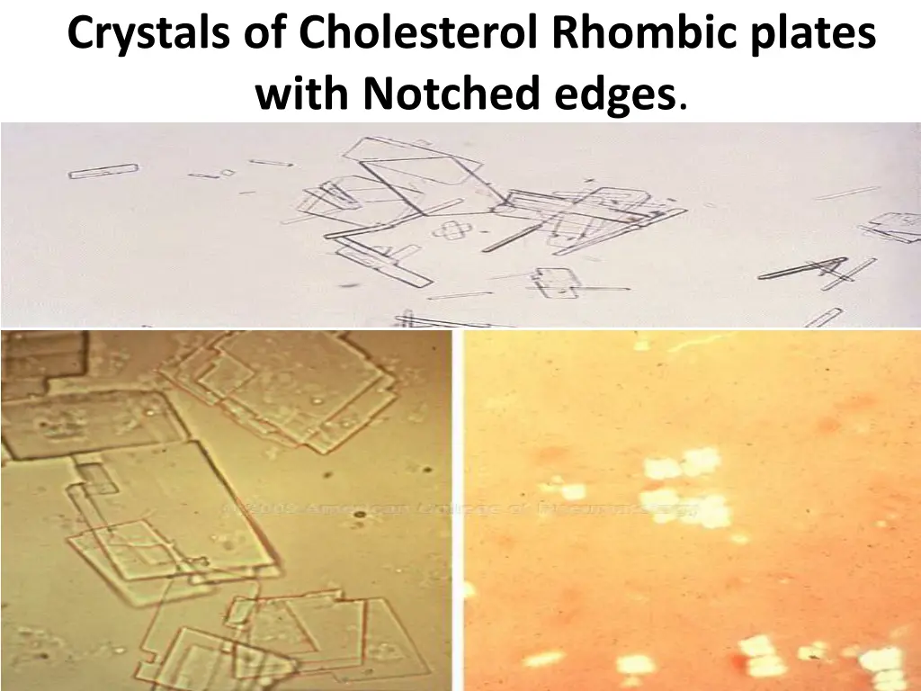 crystals of cholesterol rhombic plates with