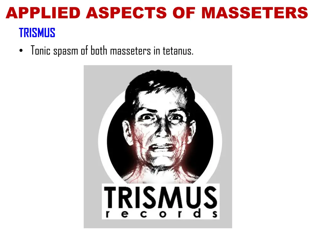 applied aspects of masseters trismus tonic spasm