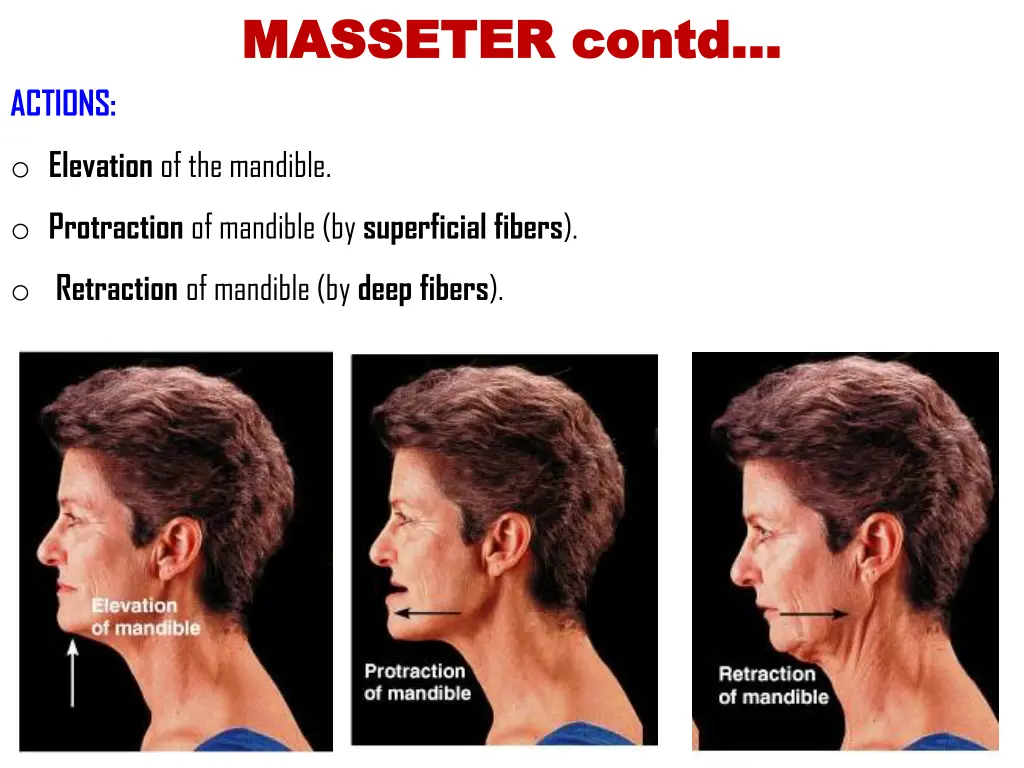 masseter masseter contd