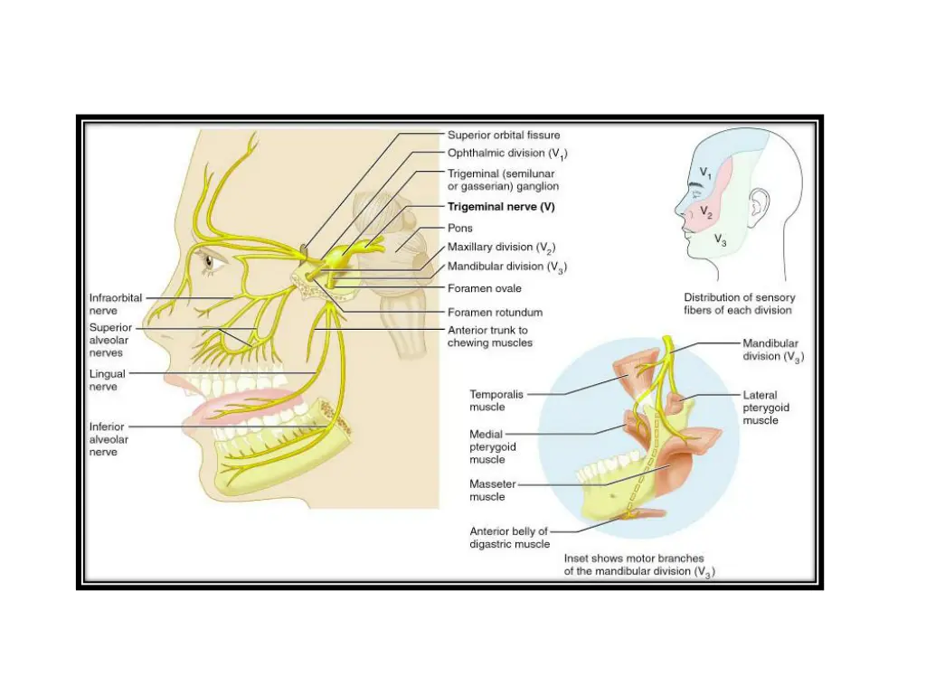 slide18