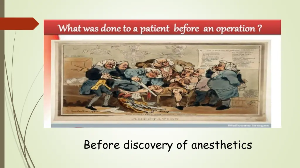 before discovery of anesthetics