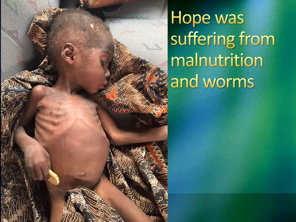 hope was suffering from malnutrition and worms