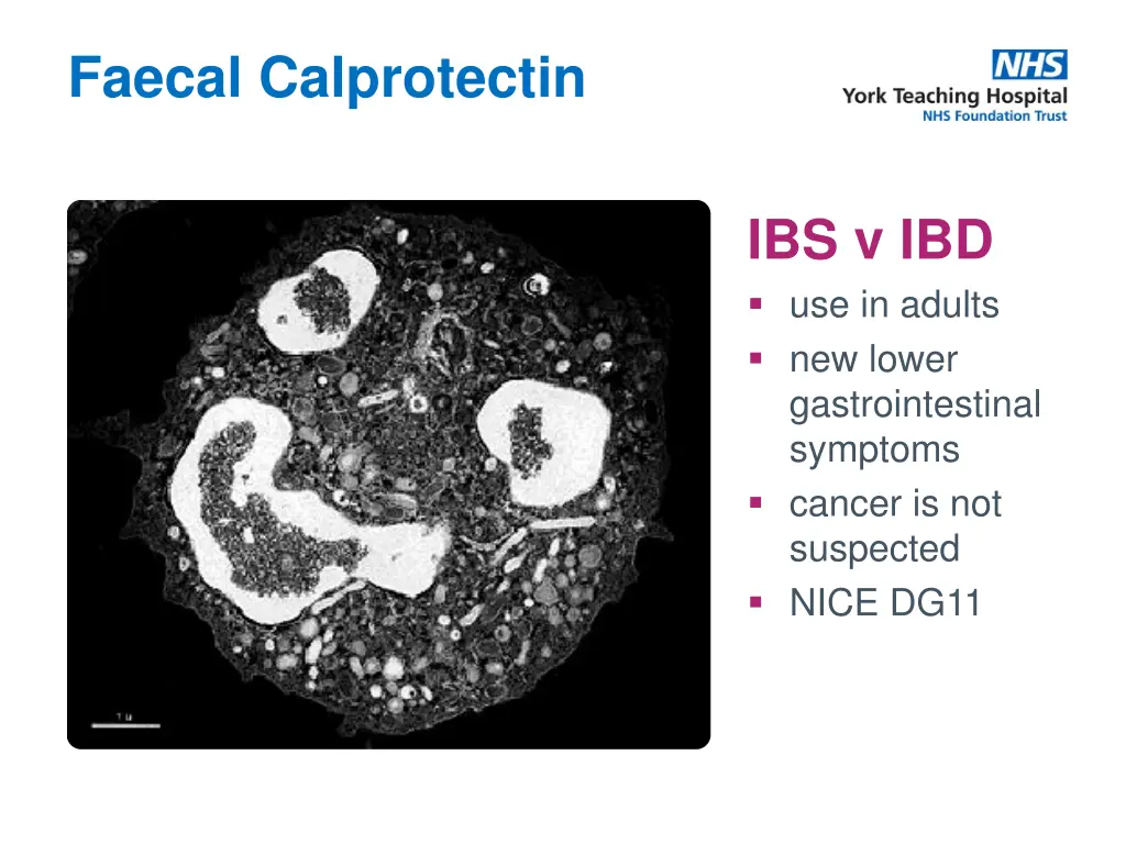 faecal calprotectin