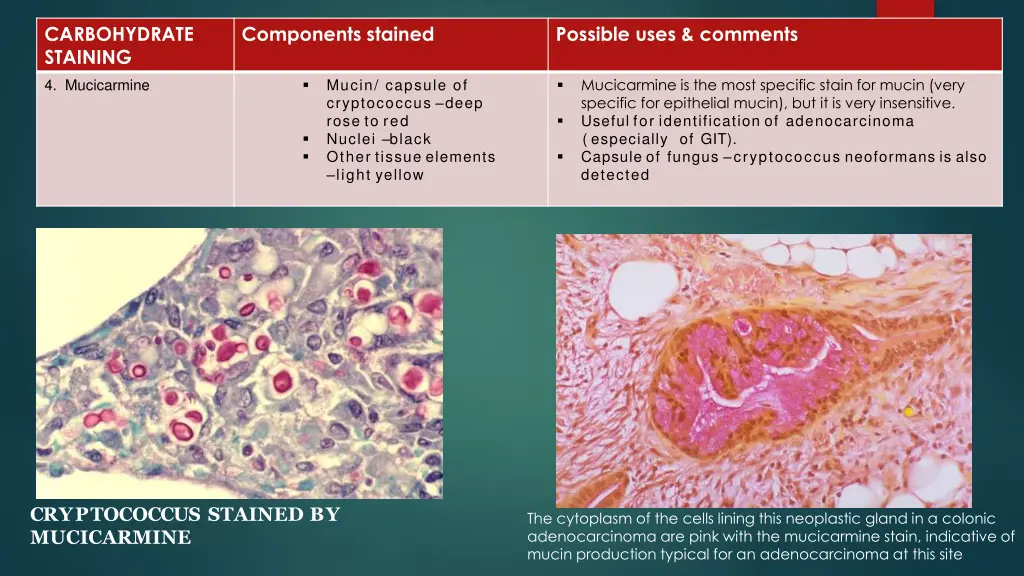 carbohydrate staining 2