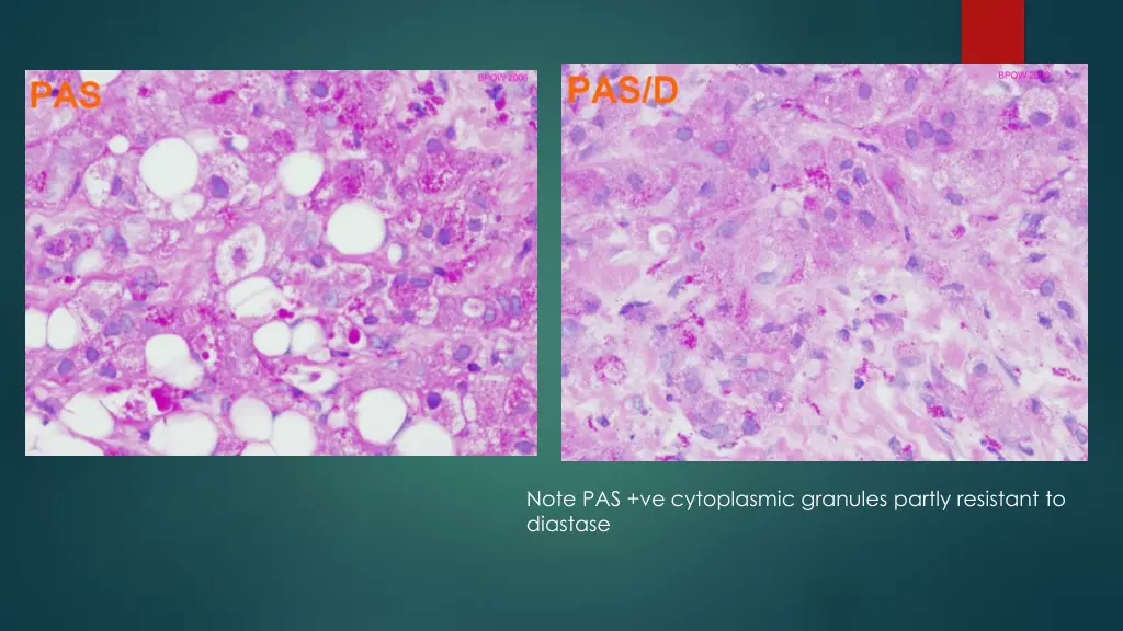 note pas ve cytoplasmic granules partly resistant