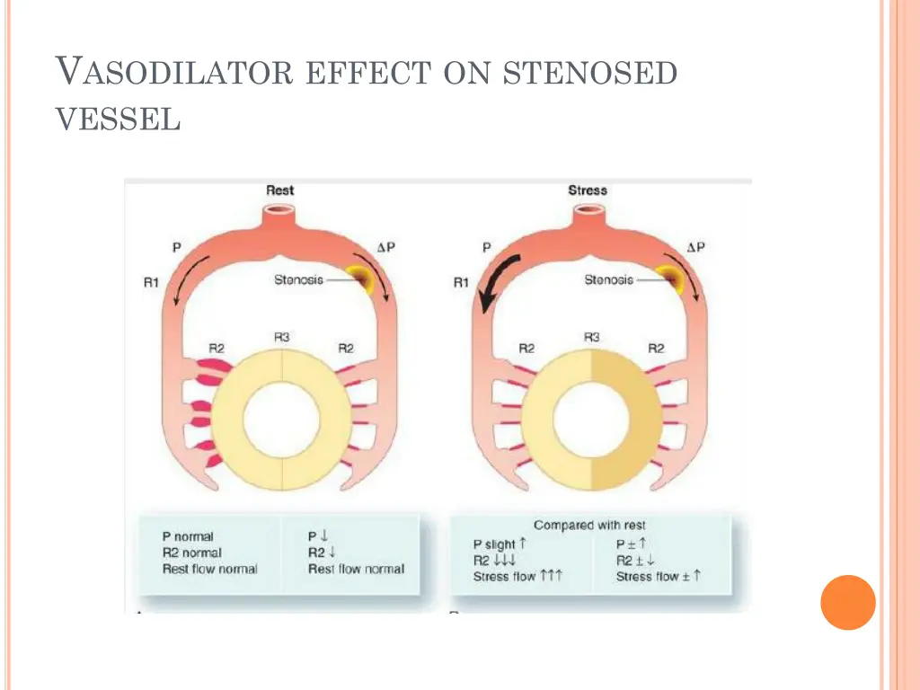 v asodilator effect on stenosed vessel