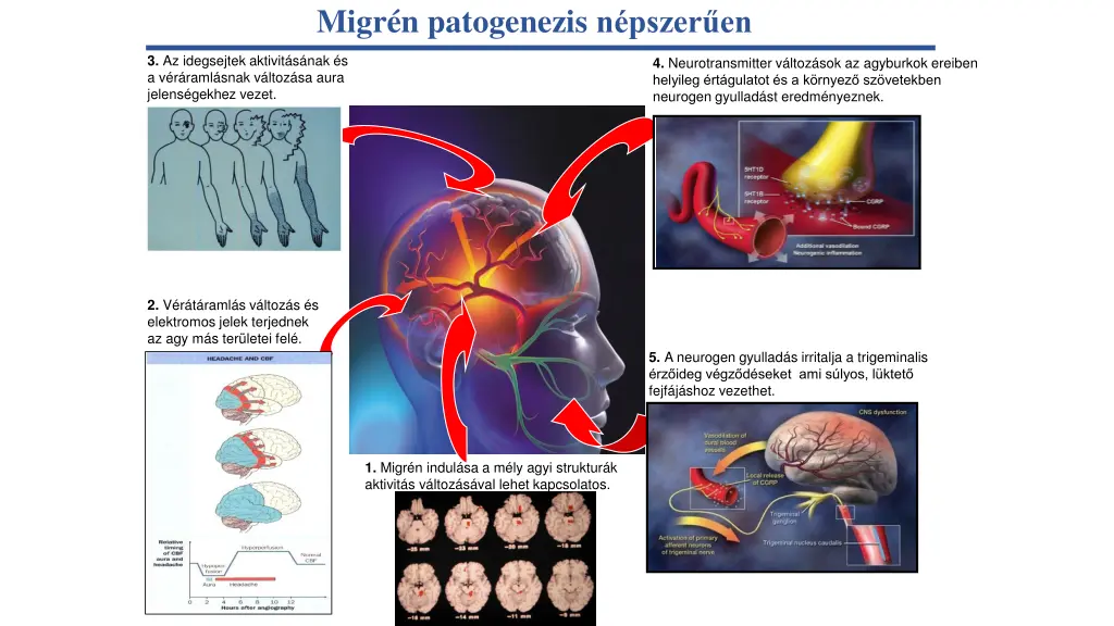 migr n patogenezis n pszer en