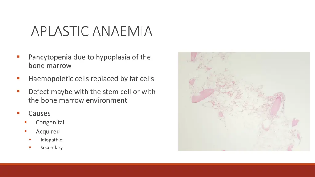 aplastic anaemia