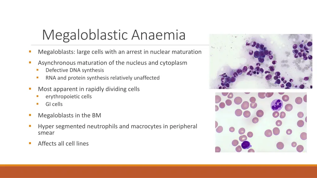 megaloblastic anaemia